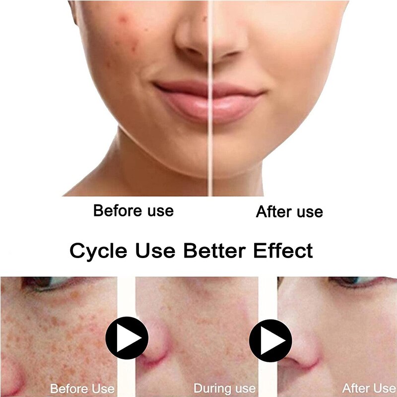 Turmeric Freckle Whitening Serum