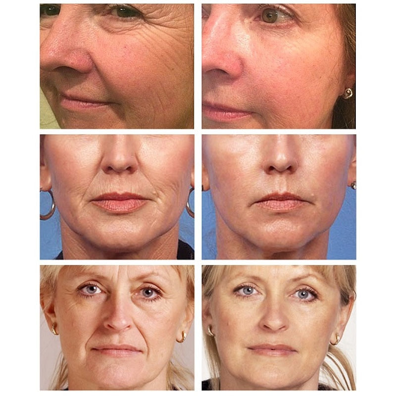 Collagen Wrinkle Removal Cream