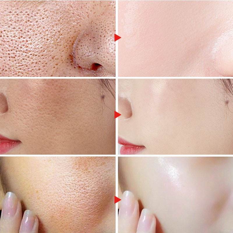 Lactobionic Acid Pore Shrinking Face Serum