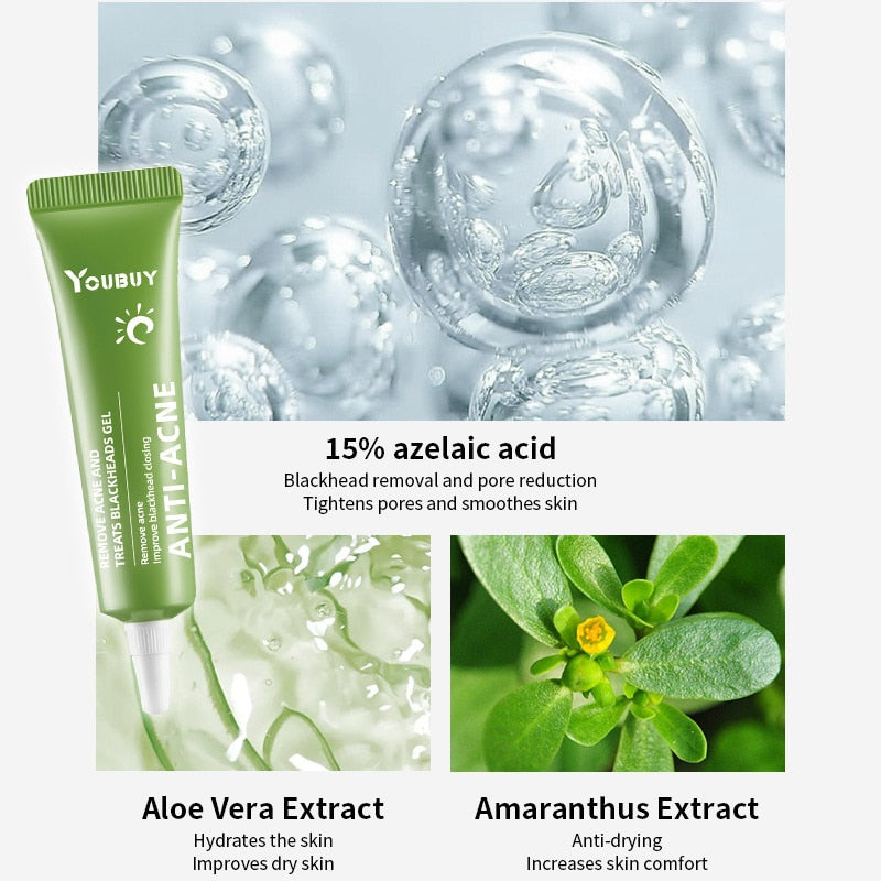 Acne Removal Whitening Cream