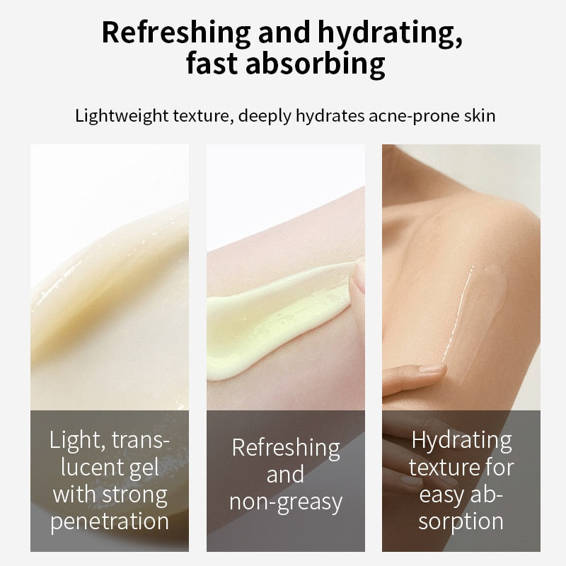 Acne Removal Whitening Cream